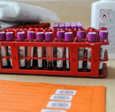 Badania Warty Poznań